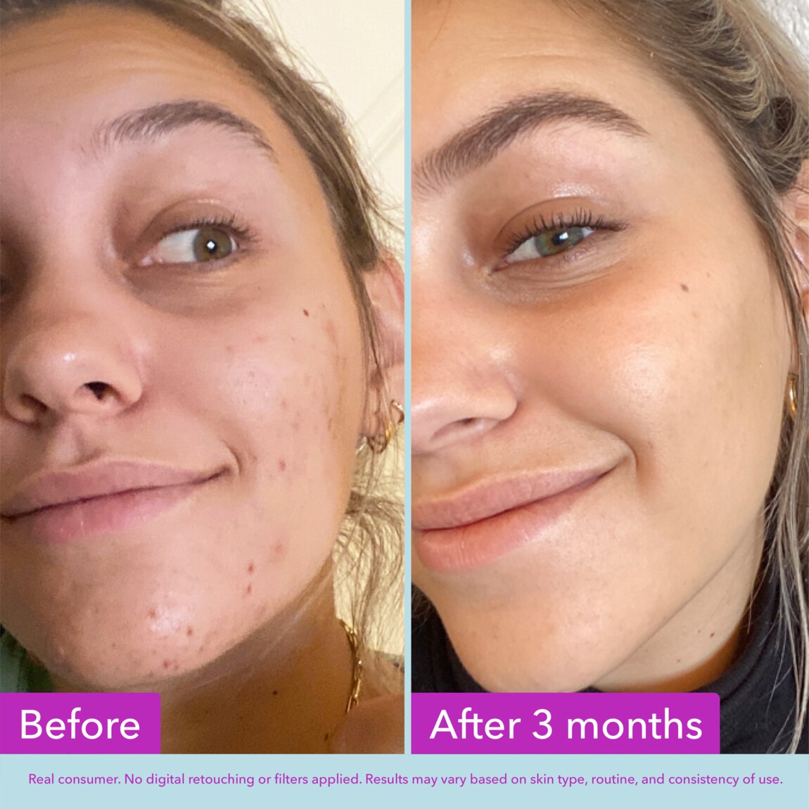 niacinamide-brightening-toner-x5 zb_p.jpg
