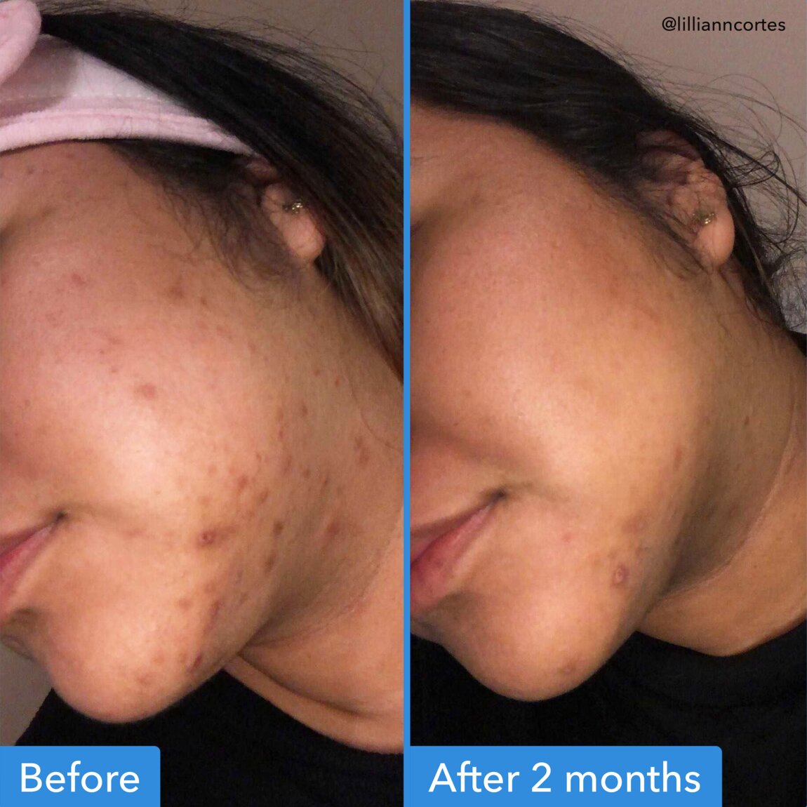 discoloration-correcting-serum-i8 zb_p.jpg