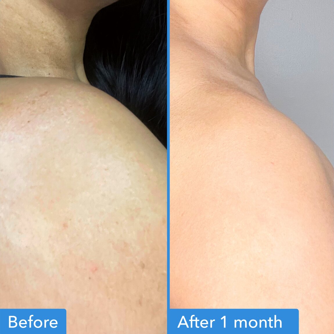 discoloration-correcting-body-treatment-h5 zb_p.jpg