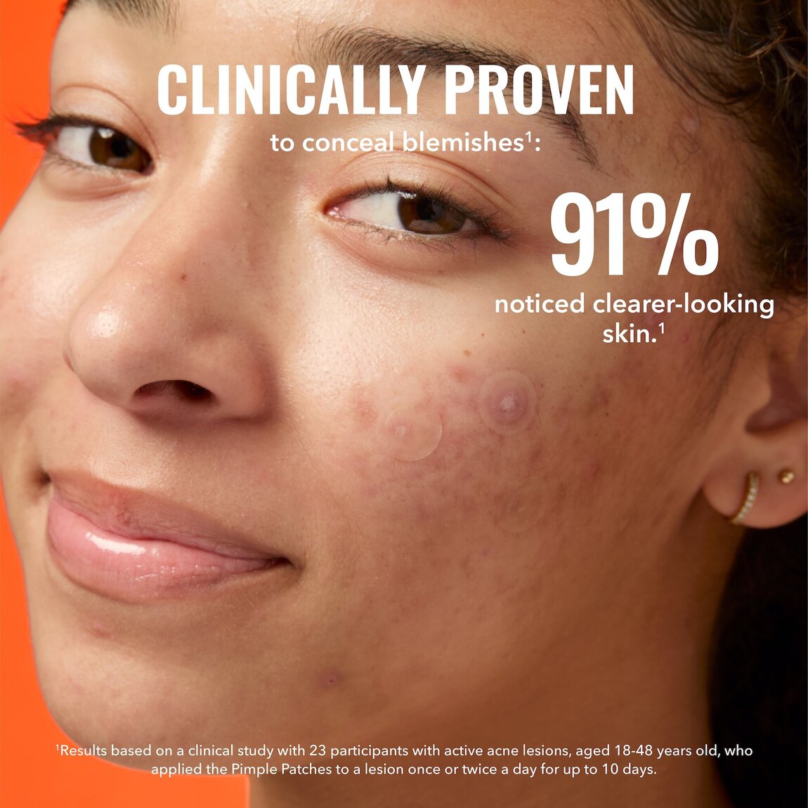 pimple-patches-p3 zb_p.jpg
